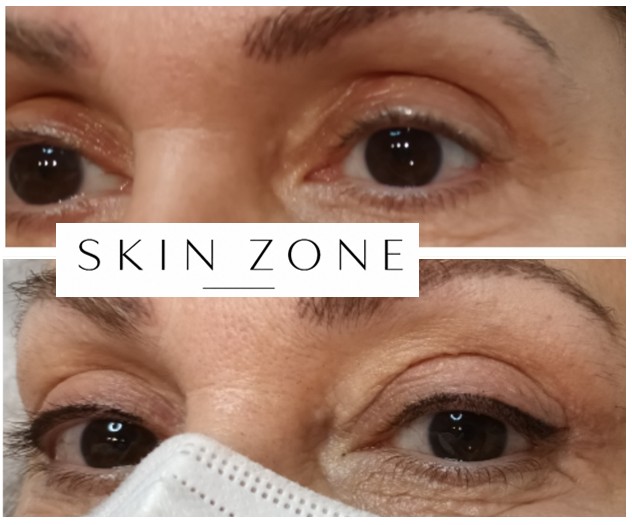 Ημιμόνιμο eyeliner