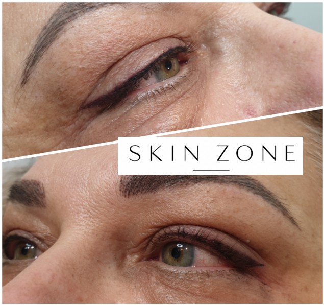 Ημιμόνιμο eyeliner — αποτέλεσμα