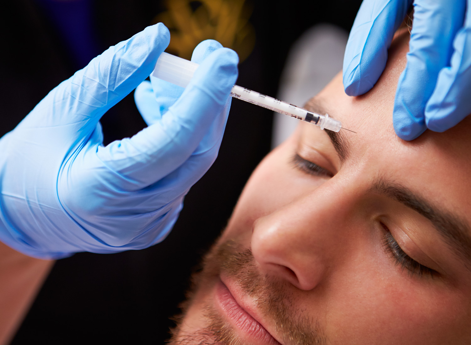 Botox αποτέλεσμα