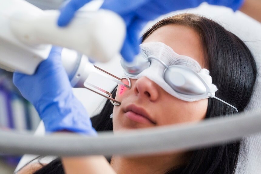 Laser Fractional CO2
