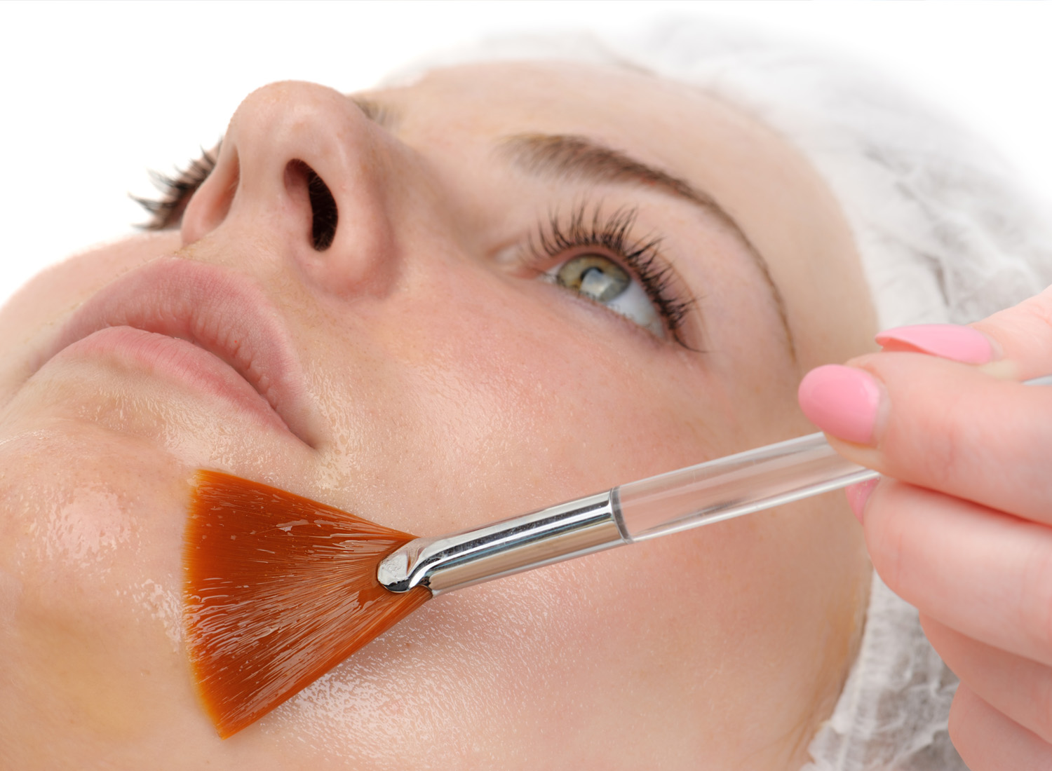 Χημικά Peeling
