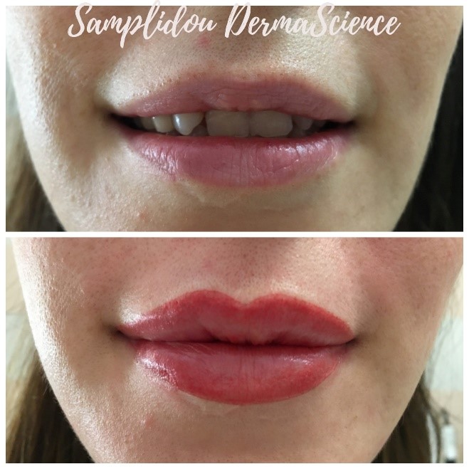 Lips classic